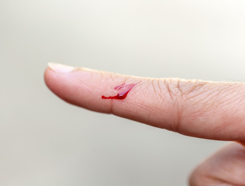 papír vég ujj fáj miért