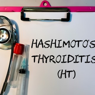 Hashimoto-betegség: tünetei, lefolyása, kezelése - orvosi válaszok a tévhitekre című cikk nyitóképe