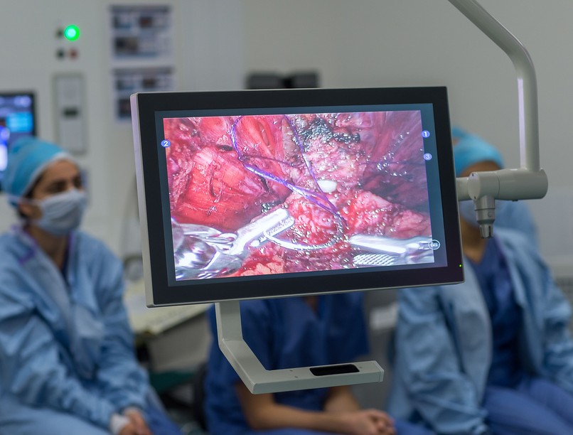 endoszkópos kezelés endoszkópos sebészet leírás