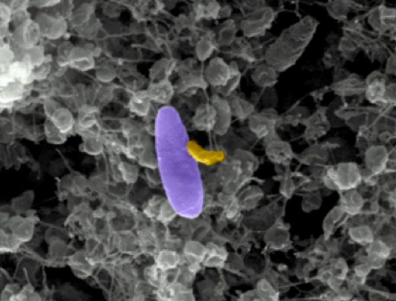 Micavibrio aeruginosavorus, vámpír-baktérium, antibiotikum, bioterrorozmus