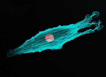 Megjósolhatóvá válhat az áttét? Új módszer jelezte, mekkora eséllyel képez áttétet a rák című cikk nyitóképe