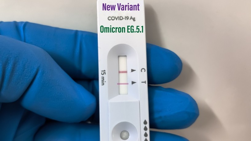 covid Eris tünetei koronavírus omikron-variáns