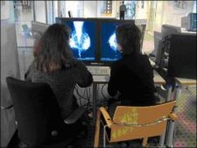 Emlőrák: a kulcs a korai diagnózis