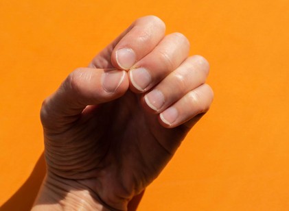 Egy sötét csík, egy furcsa forma – 5 jel, amikor a körmök daganatra figyelmeztetnek című cikk nyitóképe