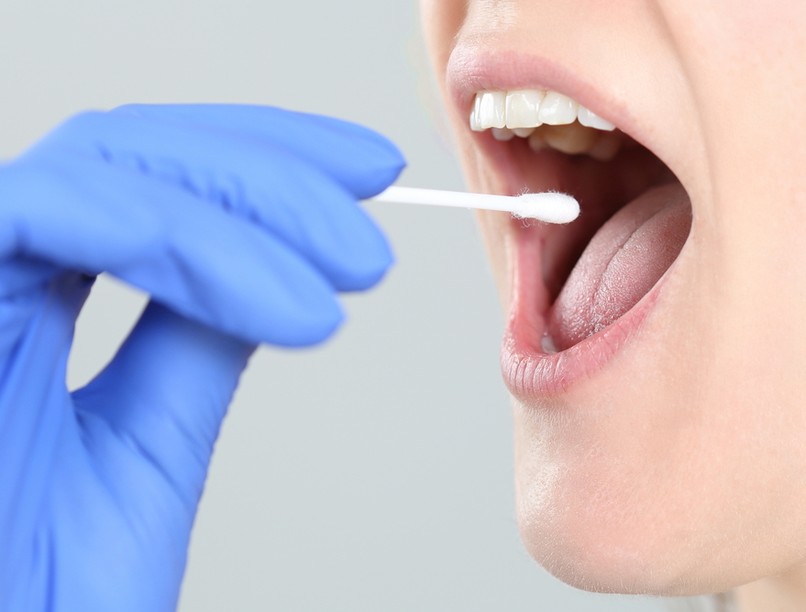 nyál, nyálteszt, diagnózis, vizsgálat