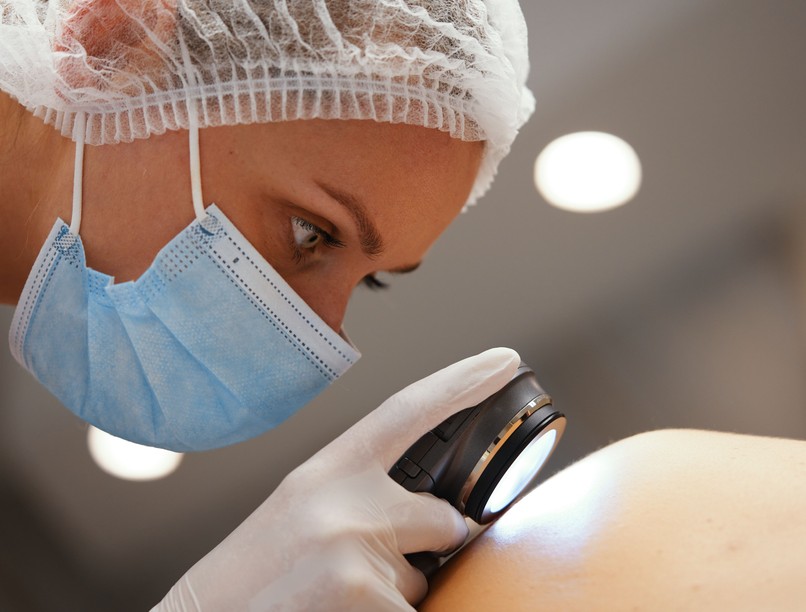 bőrrák, bőrdaganat, melanoma, fényvédelem