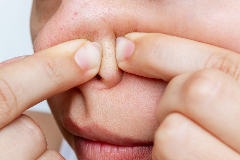 Súlyos tévedés: ezt a három dolgot soha ne tegye a miteszerrel!