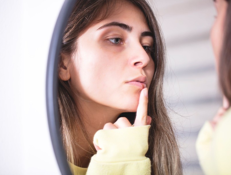 herpesz, koronavírus, tünet, afta, covid