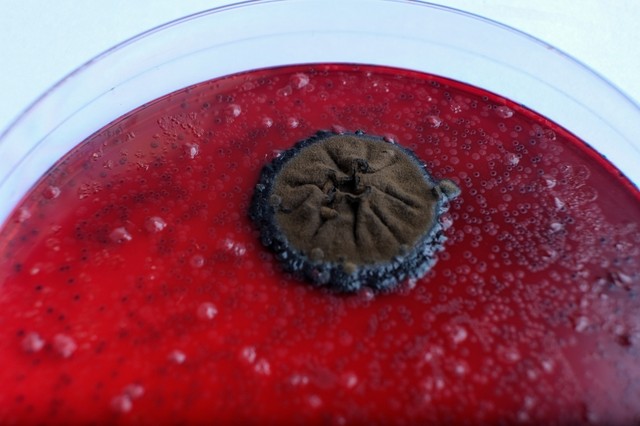 Elképesztő gyorsasággal fertőz ez a nemi úton terjedő baktérium