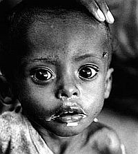 Túlsúly? Éhezés? - helytelen táplálkozás a világban