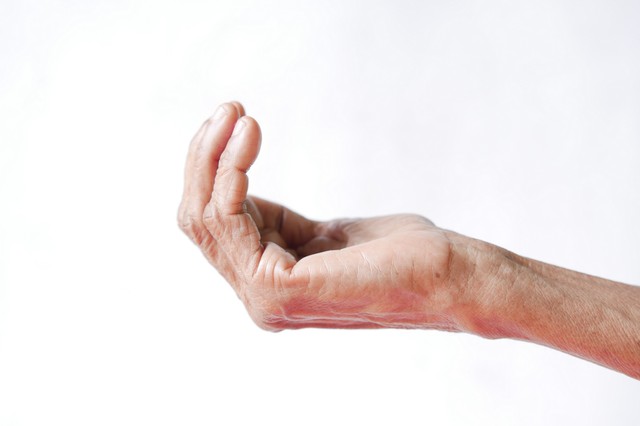 Ilyenek a daganat tünetei a tenyéren és az ujjakon