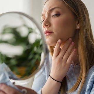 Száraz bőr: nem csak esztéikai probléma, betegséget is jelezhet című cikk nyitóképe