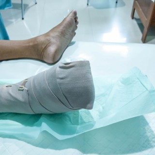 Bürger-kór tünetei, vizsgálataés kezelése című cikk nyitóképe