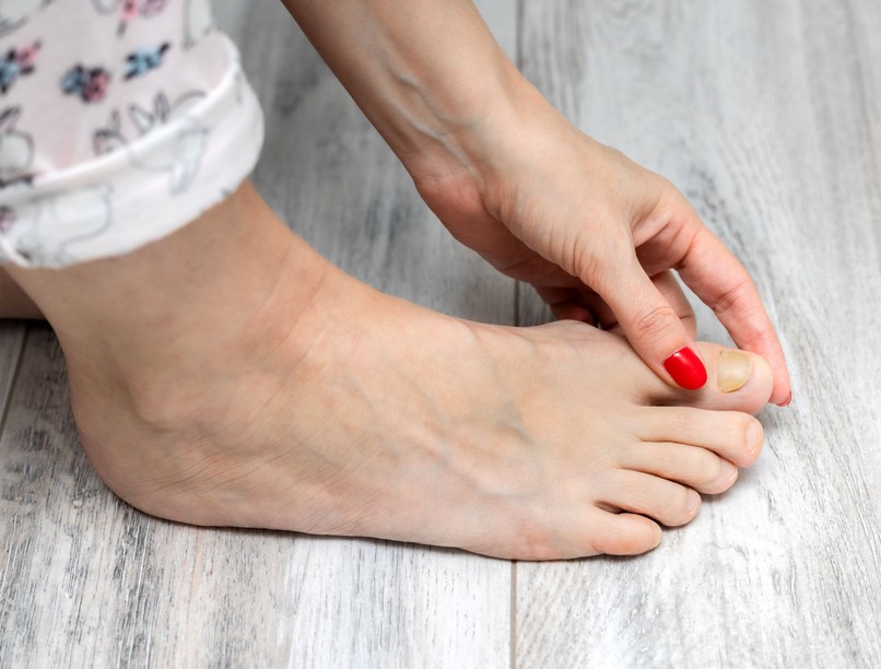 körömgomba ellen természetes módszerek