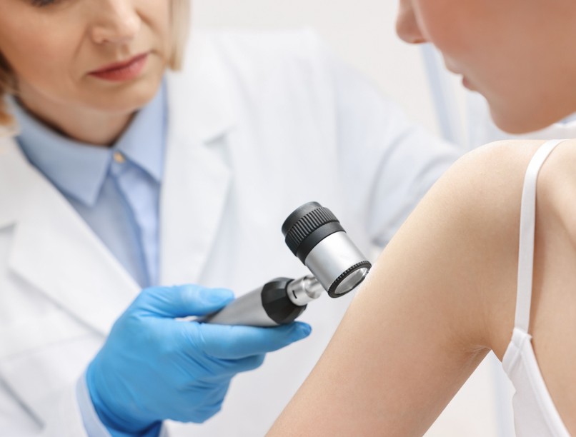 ősz anyajegy szemölcs levétel bőr hírek