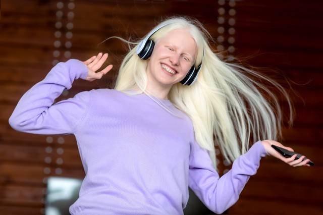 Albinizmus: tünetei, vizsgálata és kezelési lehetőségei