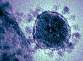 Valódi veszélyek: új vírus bukkant fel!