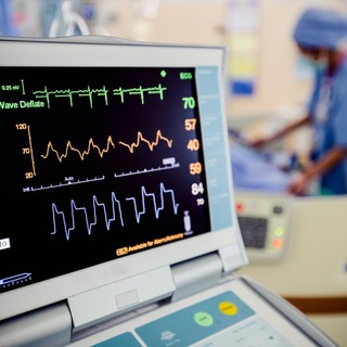 Az EKG típusai: mikor, melyik vizsgálatra van szükség? című cikk nyitóképe