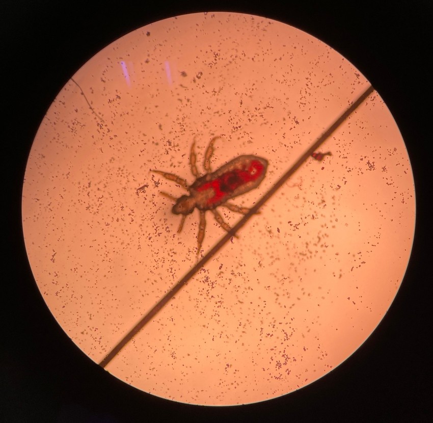 A ruhatetvek veszedelmes fertőzések terjesztői lehetznek. Életük nagy részét az emberi ruházat (pl. fehérnemű) belső, testtel érintkező felületén töltik. Rendszerint a varrások mentén lapulnak meg, ide rakják a petéket is. Csak vérszívások alkalmával tartózkodik közvetlenül az emberi testen.