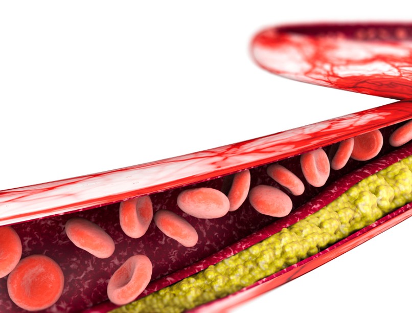 koleszterincsökkentés