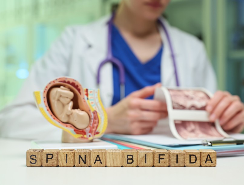 Nyitott gerinc tünet vizsgálat kezelés