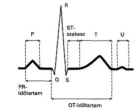 Még mindig az EKG-ról: néhány érdekesség
