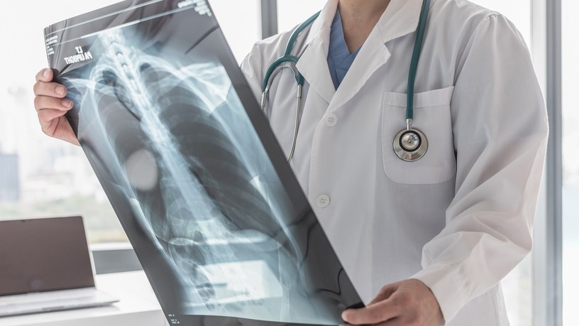 dohányzás, köhögés, copd, vizsgálat