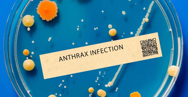 Anthrax (lépfene): tünetei, vizsgálata és a kezelési lehetőségei