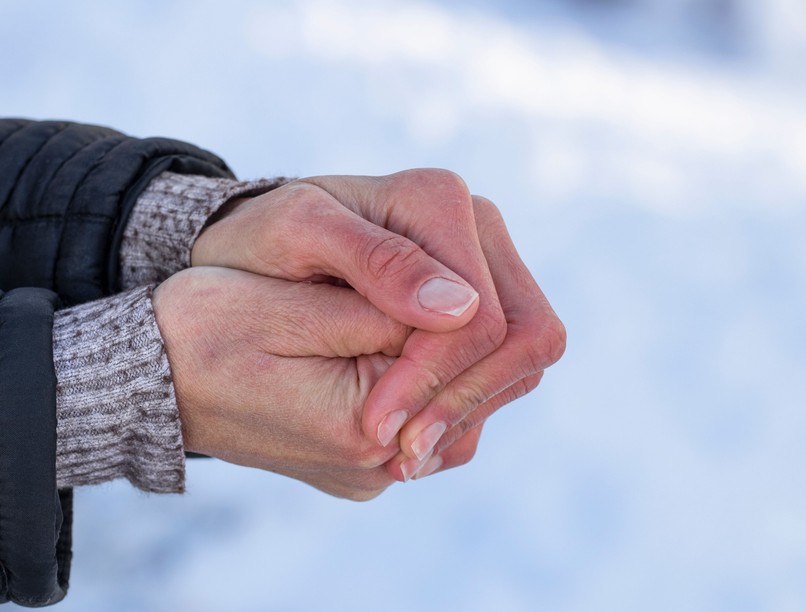 hideg, hipotermia, alacsony testhőmérséklet, kihűlés