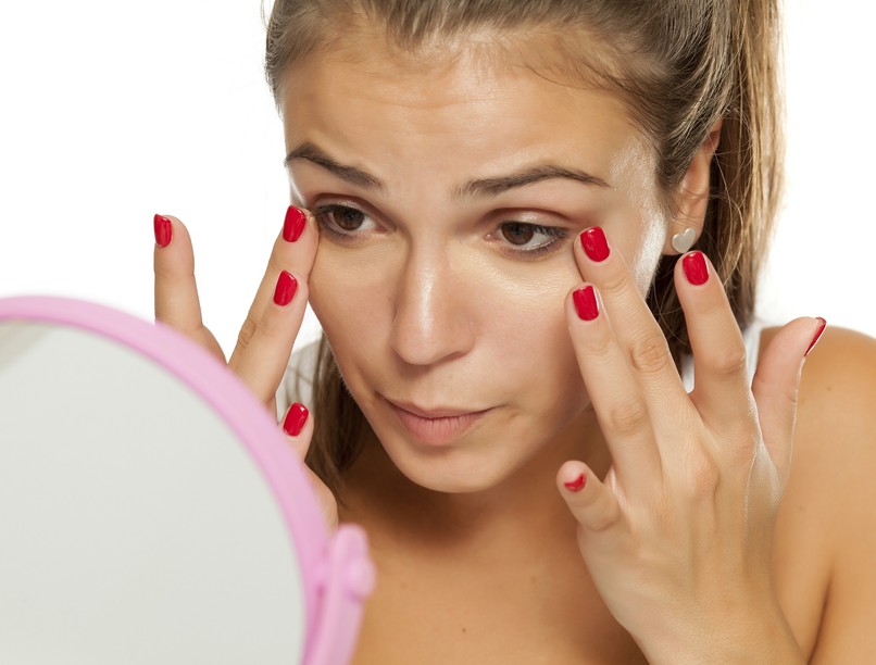 szem alatti karikak, vashiány, hiperpigmentáció