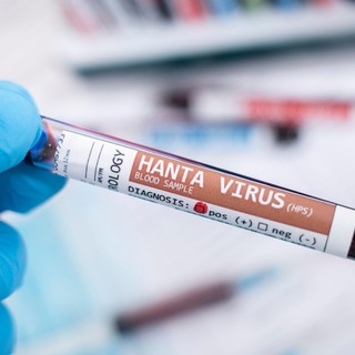 Már dolgoznak a hantavírus elleni vakcinán című cikk nyitóképe