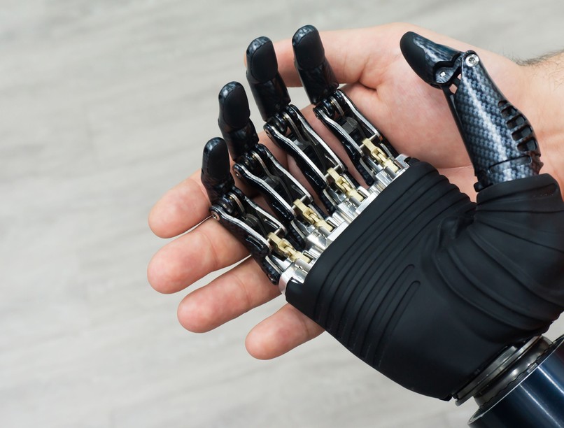 protézis, amputáció, ukrajna