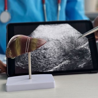 Hogyan gyógyítható a májrák? A modern onkológia valódi lehetőségei és korlátai  című cikk nyitóképe