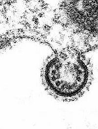 Kutya védi meg a gyereket az asztmától?!