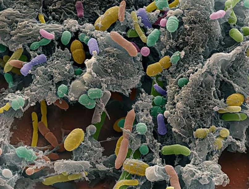 lactobacillus-rhamnosus