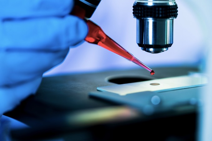 Egy új vércsoportrendszert fedeztek fel a tudósok című cikk nyitóképe