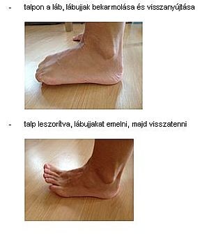 Gyógytornák: hogyan kezelhető a bütyök?