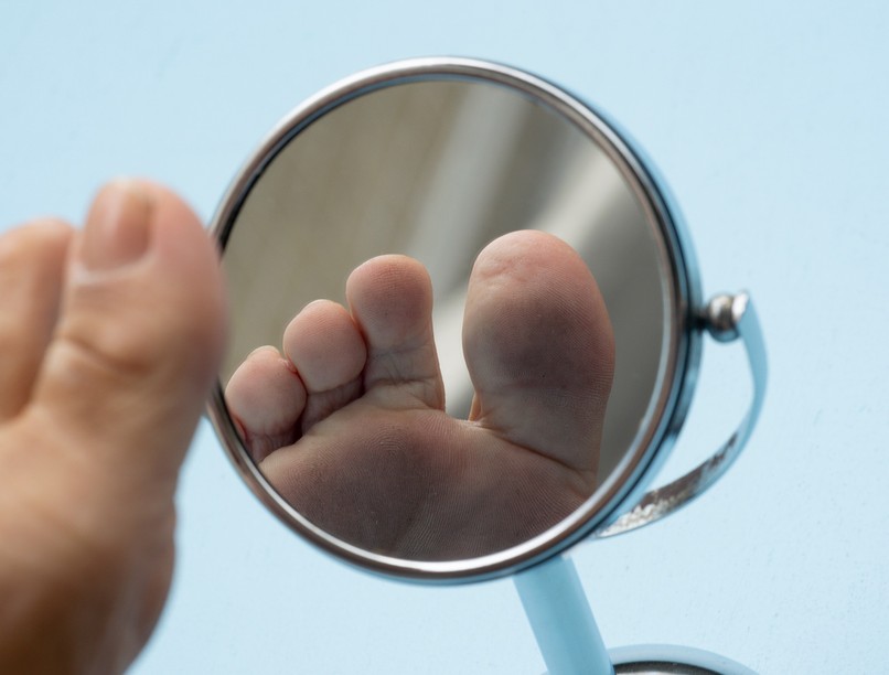 diabéteszes láb ellen megelőzés cukorbetegség