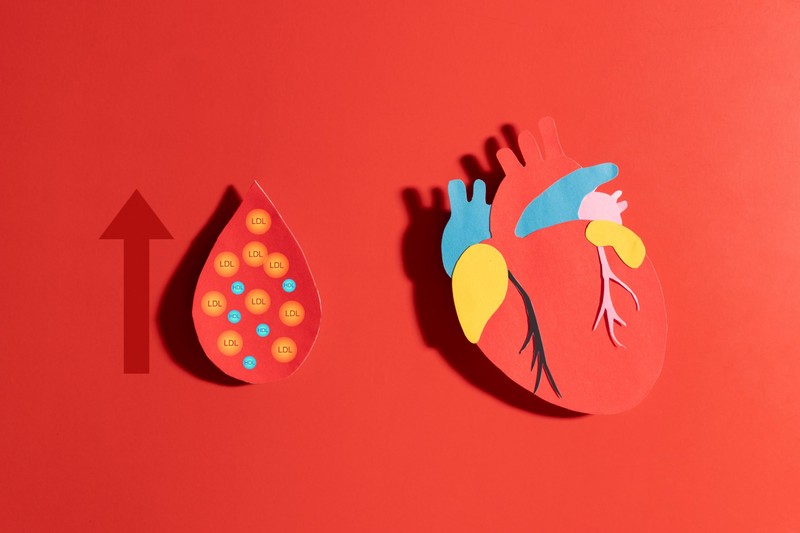 Ez az érelmeszesedés alig ismert rizikófaktora - pedig ilyen egyszerűen kimutatható a vérből