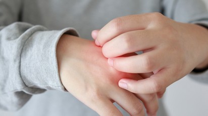 Miért viszket a bőröm télen? Ez áll a kellemetlen panasz hátterében című cikk nyitóképe