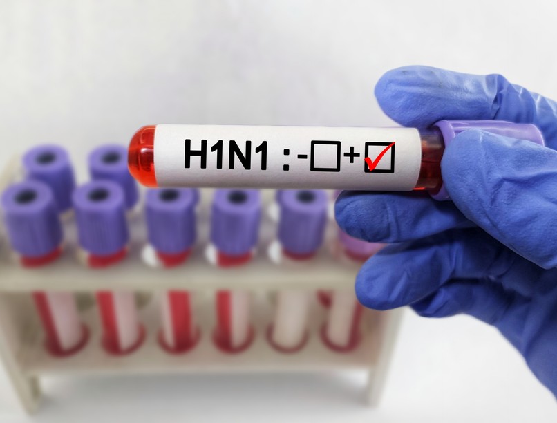 H1N1 új influenza tünet vizsgálat kezelés