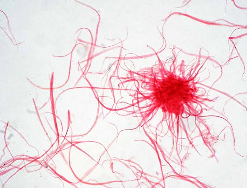 emlőrák mellrák kiújulása vírus