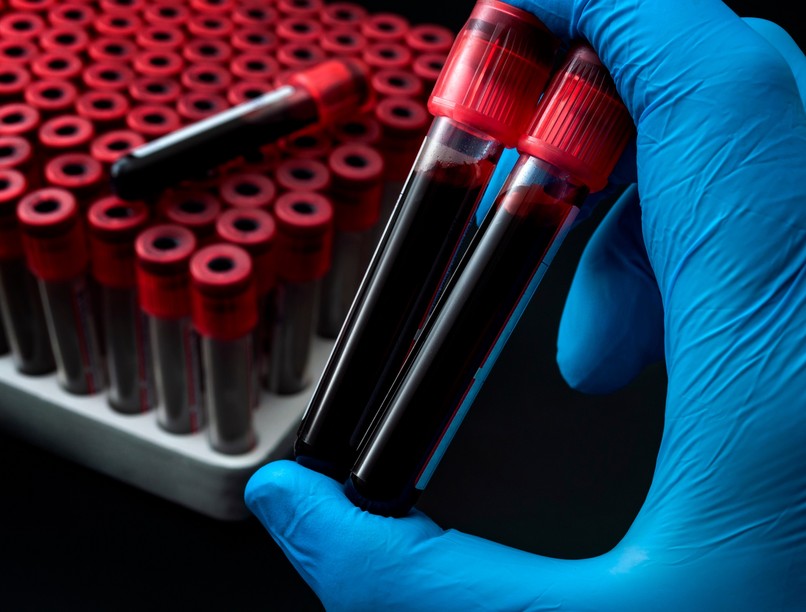 Mi a vörösvértest-süllyedés