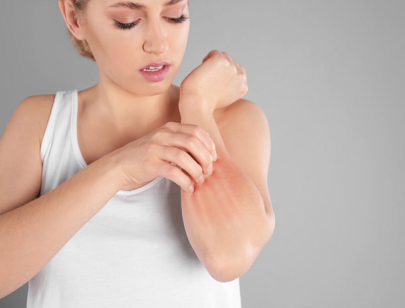 allergia, viszketés