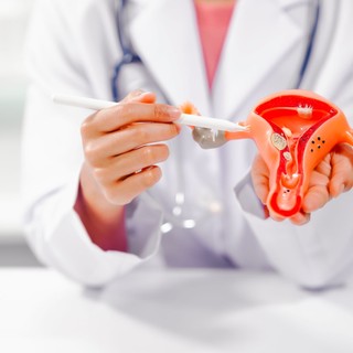 A nőgyógyász elárulta: a PCOS-sel küzdő nőknek nagyobb eséllyel születik autista gyermekük című cikk nyitóképe
