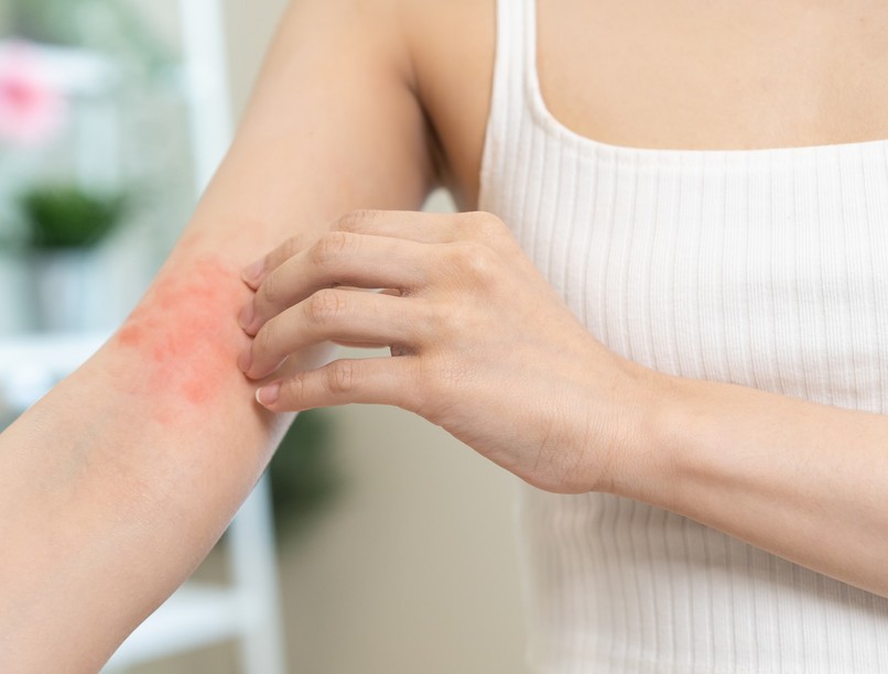 Véralvadásgátló mellékhatás folt bőr