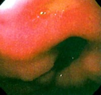 Kulcslyuk sebészet - jelen és jövő