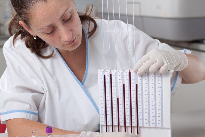 Mit jelent a We (vérsejtsüllyedés) érték a laborleleten?