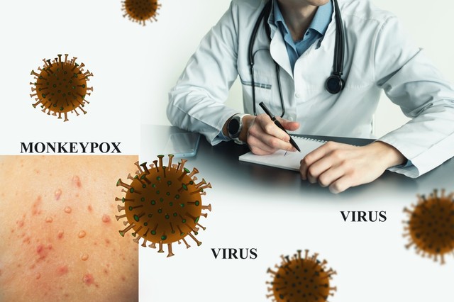 Majomhimlő: más tünetekkel jelentkezik, mint eddig - erre figyeljen!