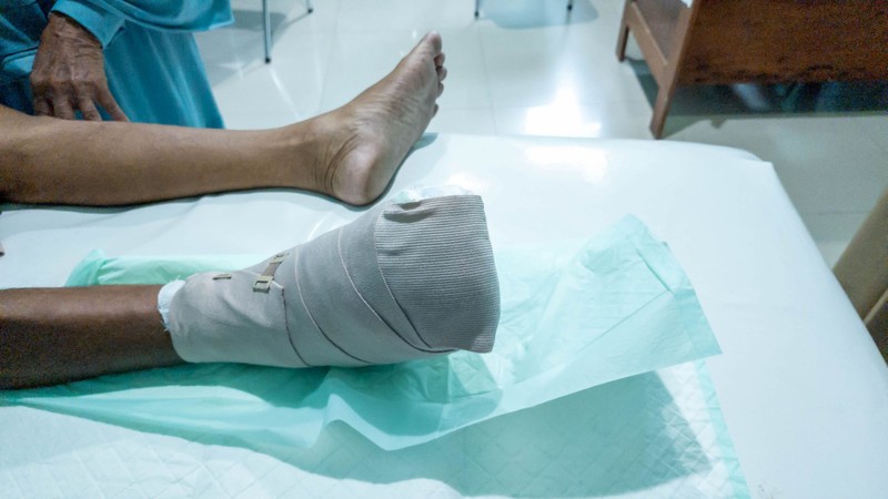 Bürger-kór tünetei, vizsgálataés kezelése